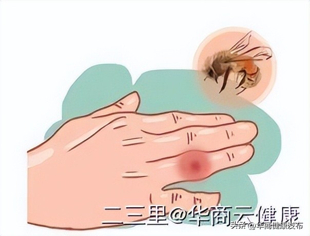 实用知识：赏花被蜂追，摆啥姿势安全？