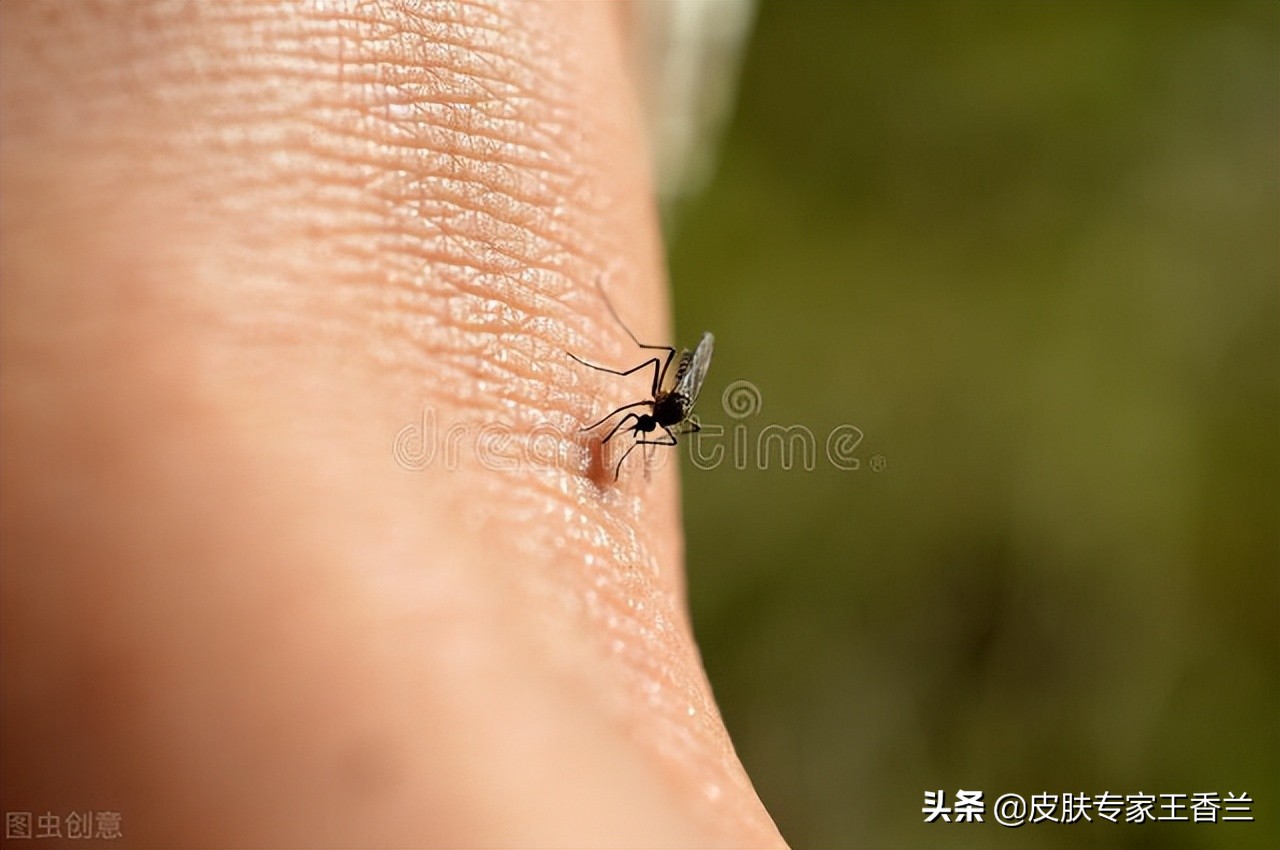 炉甘石洗剂对皮肤瘙痒有效果吗,炉甘石洗剂治疗糖尿病皮肤瘙痒