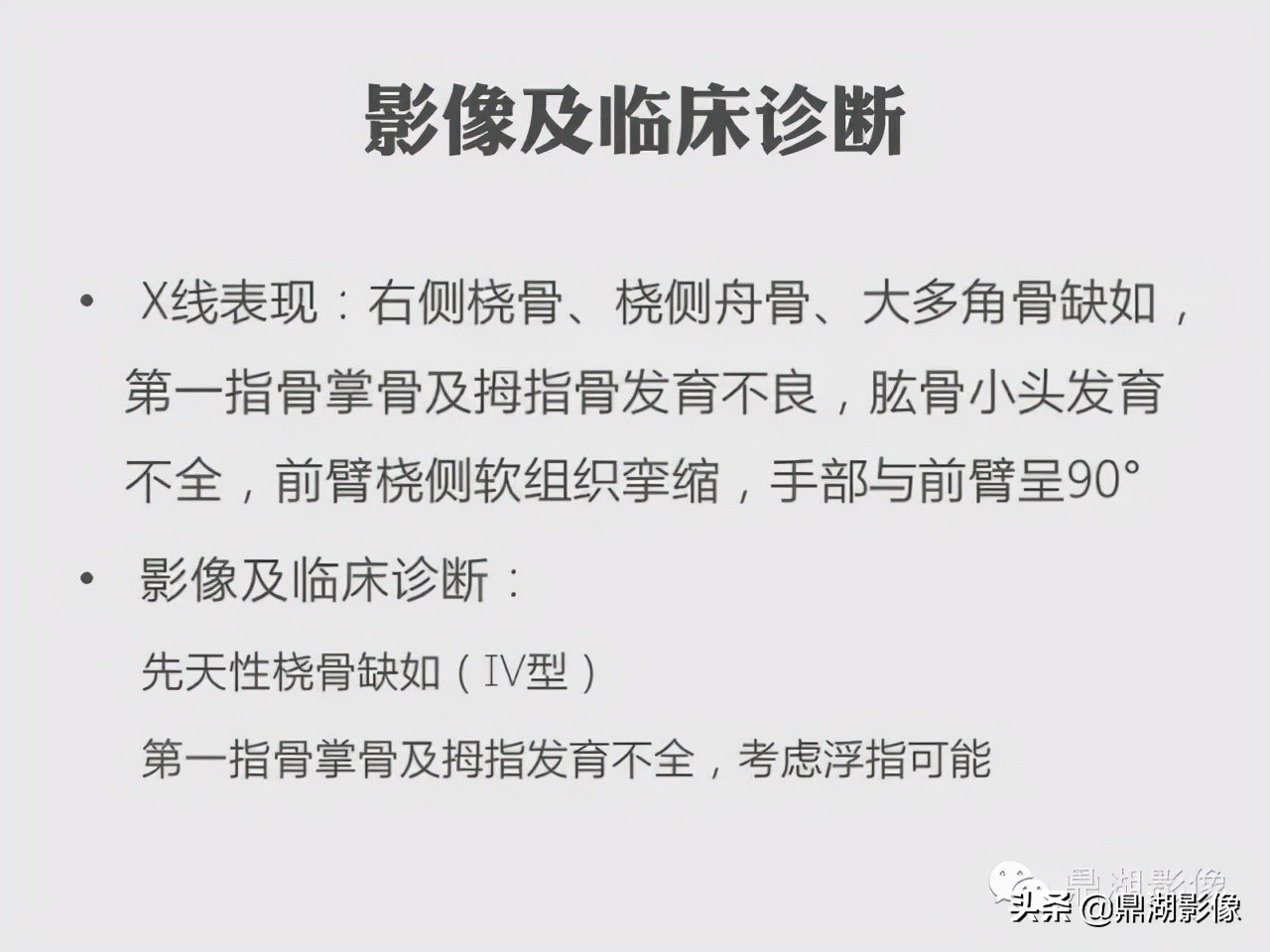 先天桡骨缺失畸形能治疗吗,先天性桡骨发育不良