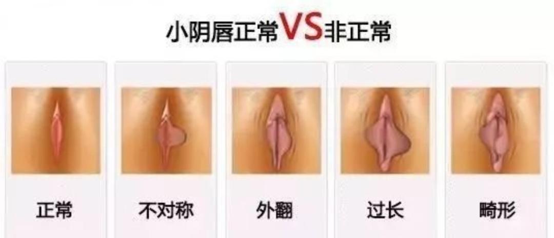 走路、骑车摩擦会痛……这个“难言之隐”该怎么解决？