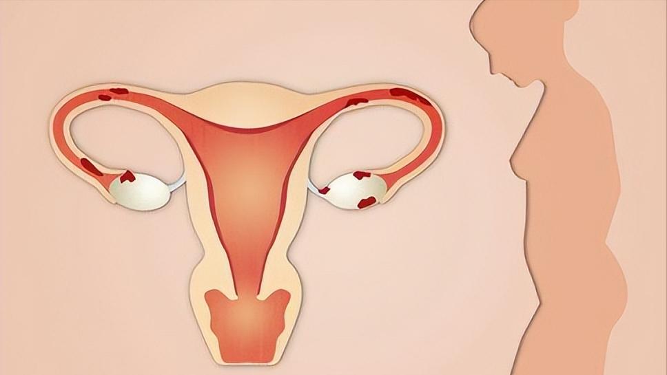 已婚女人妇科病是什么造成的,已婚女性长期分居会得妇科病吗