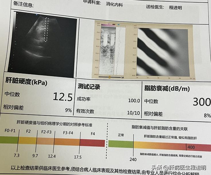 小三阳医生建议不治疗定期检查,小三阳患者自愈的概率