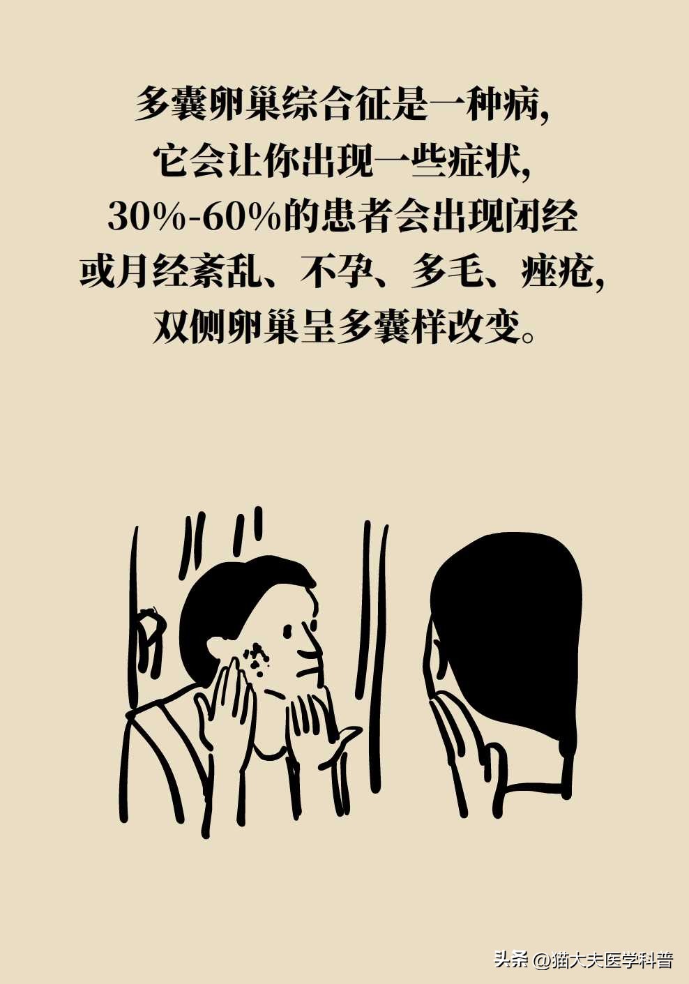 如果不要孩子多囊卵巢需要治疗吗,多囊卵巢综合征有必要治吗