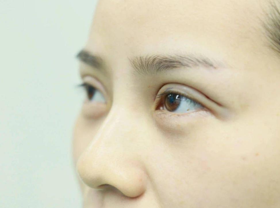 男人尿多警惕尿毒症,男人得了尿毒症会有什么表现