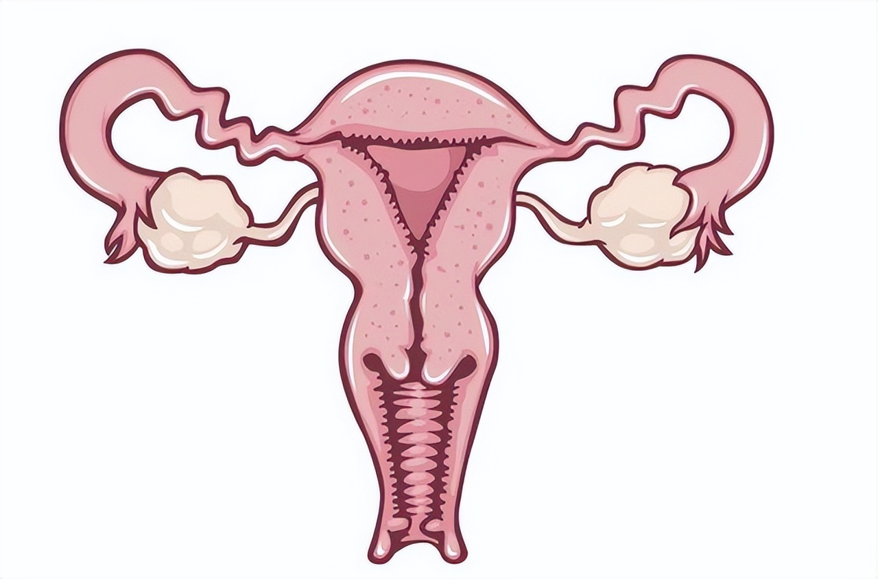 怎么避免长子宫肌瘤,什么情况才会导致长子宫肌瘤