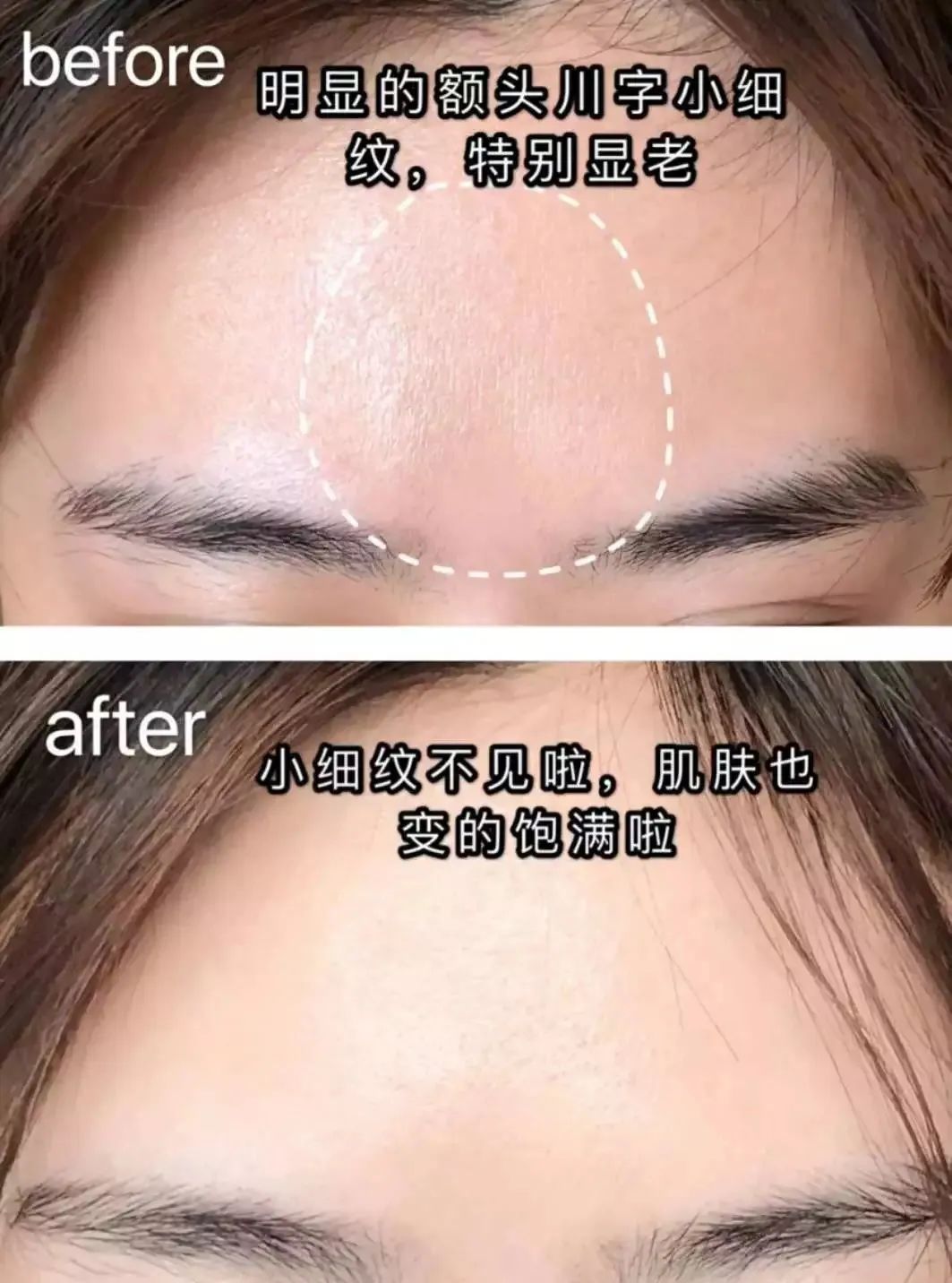 欧莱雅复颜抗皱水乳套装短视频,欧莱雅抗皱紧致水乳套装女