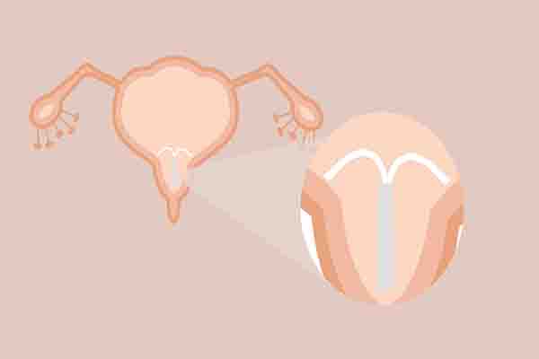 避孕贴有多大几率避孕,避孕贴有避孕效果吗