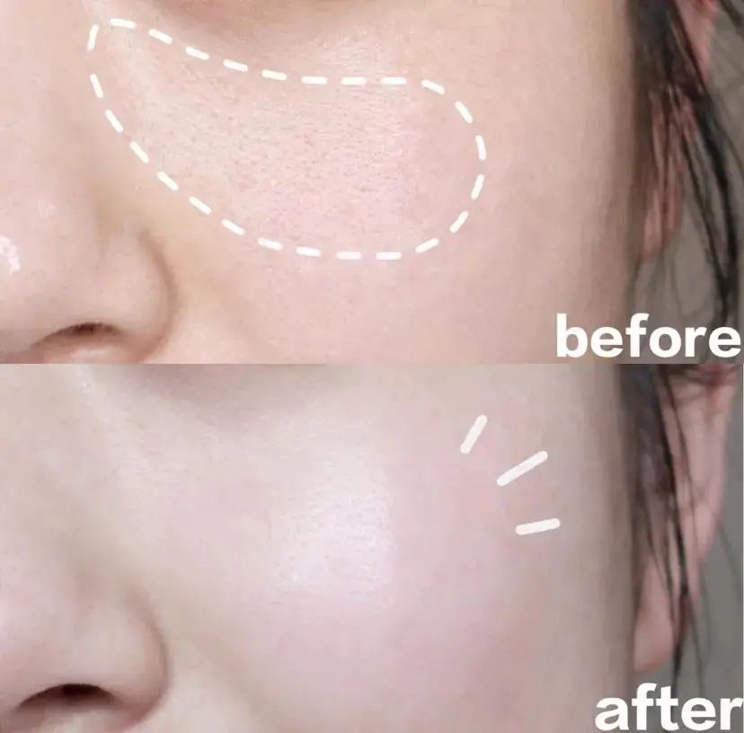 兰蔻菁纯眼精华秒杀,兰蔻菁纯臻颜玫瑰精萃水150ml价格