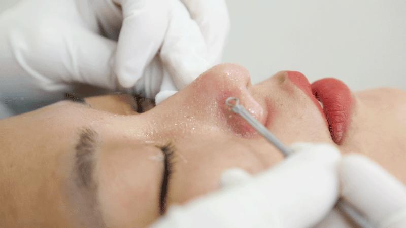 美容院护肤去黑头正常价格,小气泡去黑头美容仪器