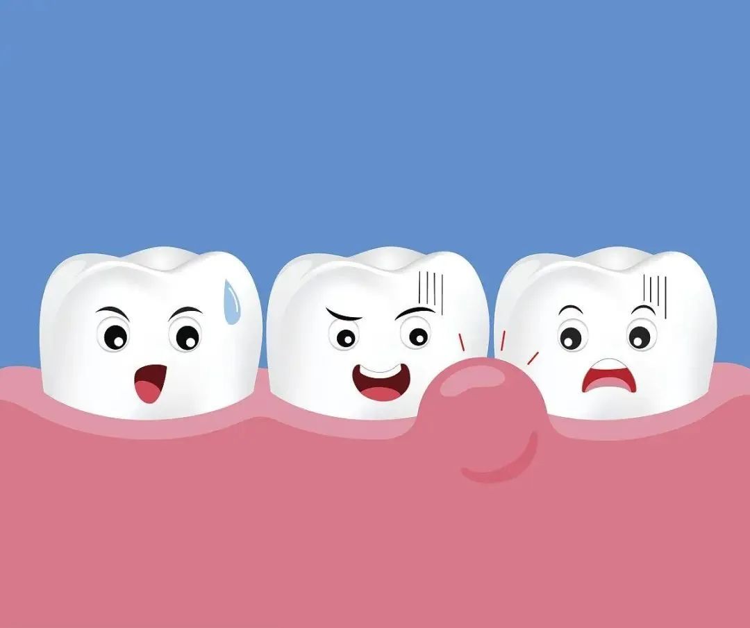 奥齿泰种植牙能用多久,种植牙多久可以抽烟