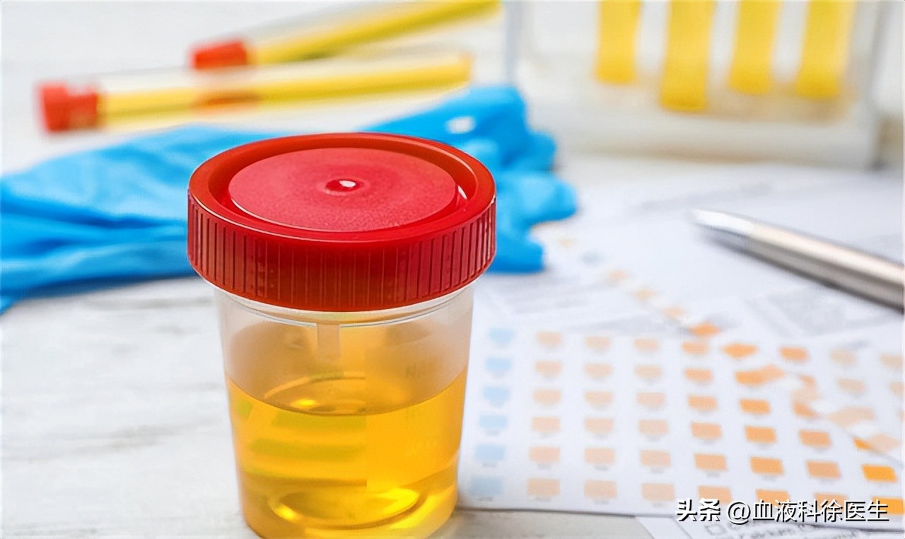 肾衰竭有这5个征兆不痛不痒,肾衰竭为什么就不排水了