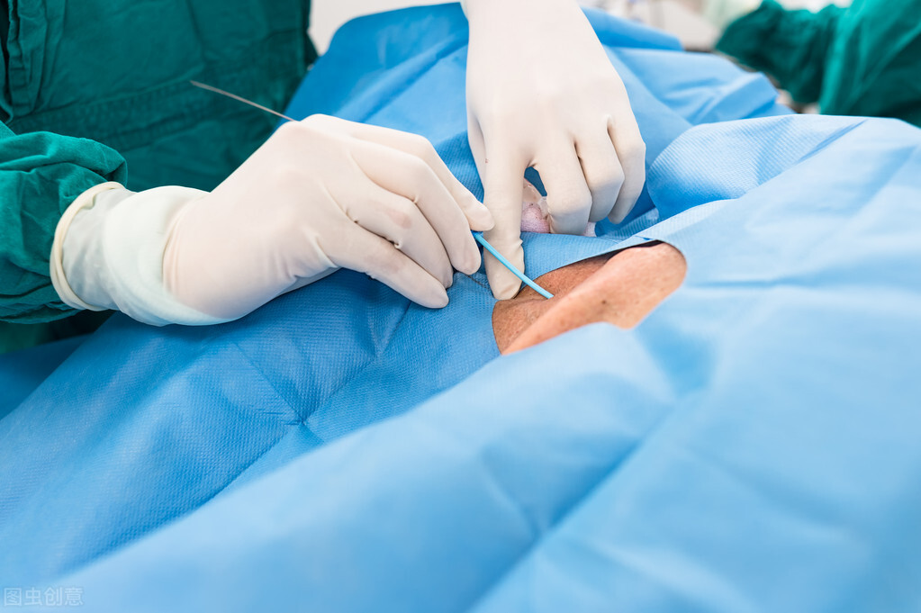 心肌梗死了还能活多久,心肌梗死能活多久