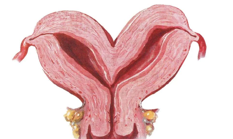 怀得上却保不住,医生提醒:子宫纵膈不解决还会胎停