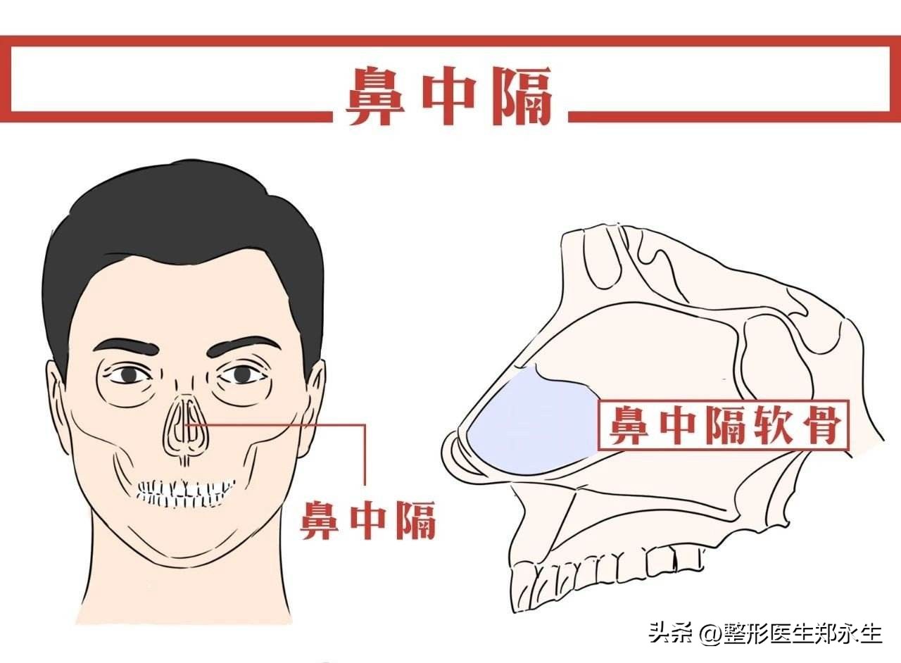鼻中隔偏曲矫正三大误解：自我矫正、徒手正骨和吃药改善
