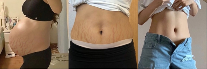 产前产后可穿短袖,产后肚皮一层皮怎么穿露脐装