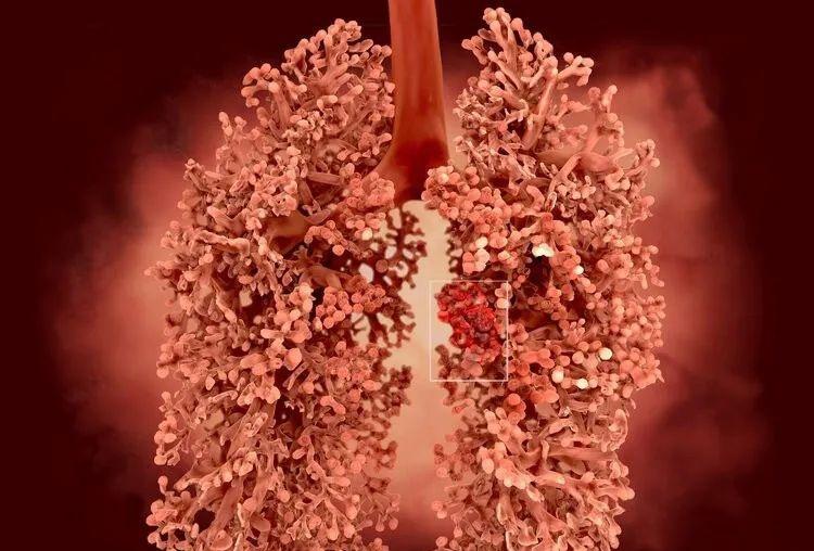 抗癌新药pd-1不限癌种吗,国内首个pd-1新药上市