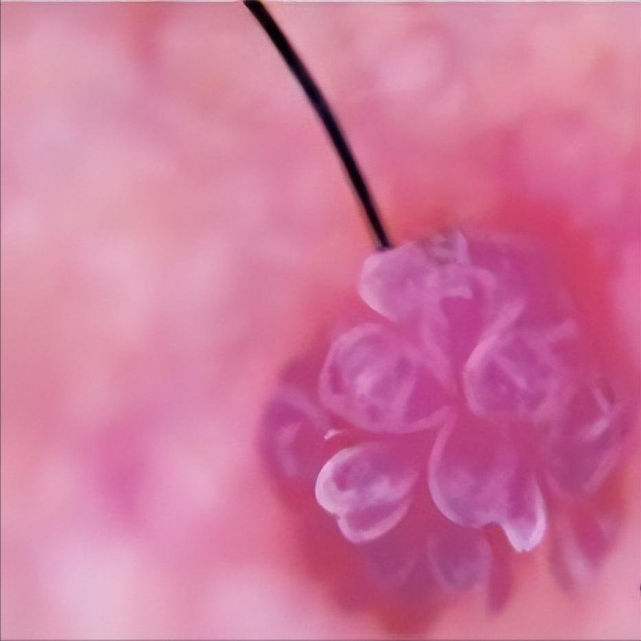 hpv病毒引起的疣是什么,hpv引起的病毒疣