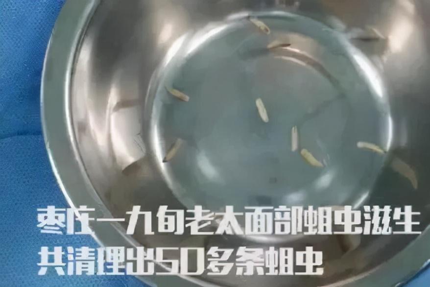 老人脸上出现疤痕发痒怎么回事,老人脸上长黑结痂痒怎么治