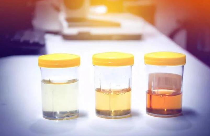 夜里起夜频繁是否肾有问题,经常起夜会不会肾衰竭