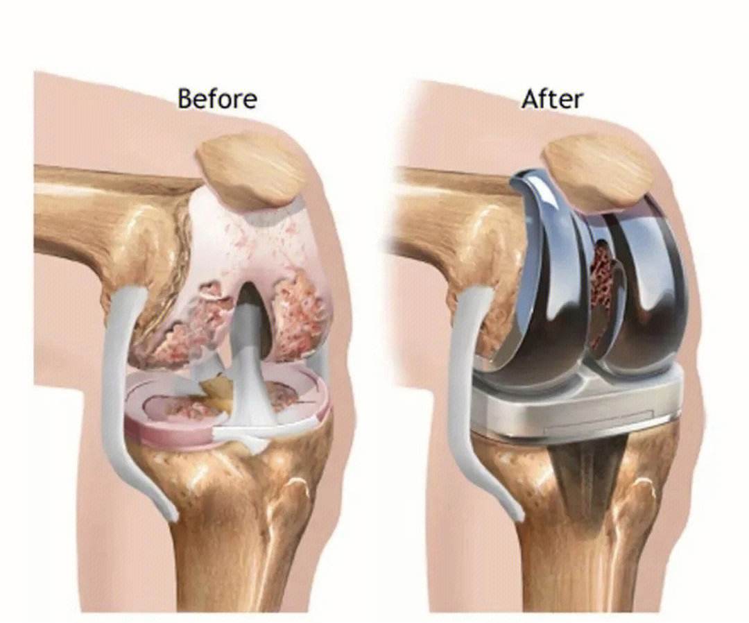 保养膝关节的养生知识,经常膝盖疼最好锻炼方法