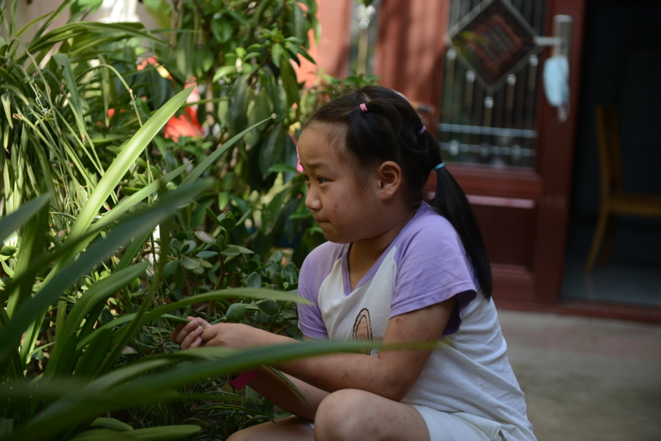 6岁女孩身患罕见病,7岁女儿患罕见病父亲不闻不问
