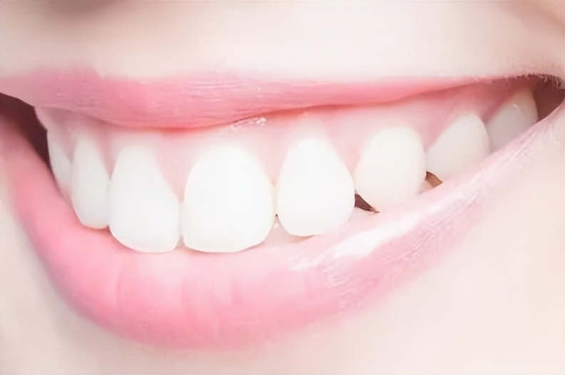 牙齿贴面的材料和品牌区别,牙贴面品牌十大排名最新