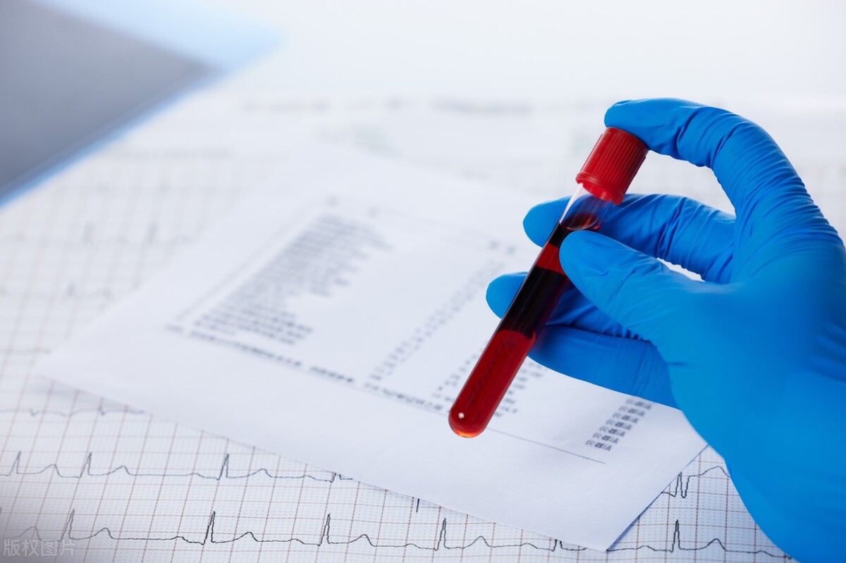 查血糖早上能喝水吃降压药吗,糖尿病早上测餐后血糖可以吃药吗