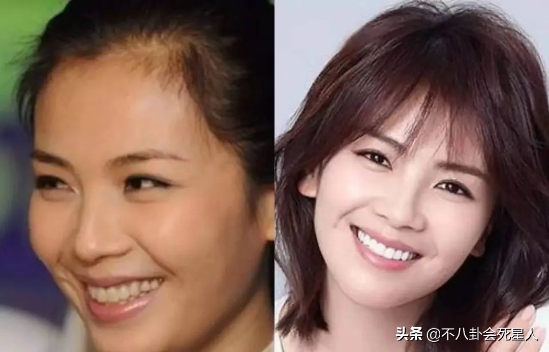 假头发假鼻子,假头发和假肚皮