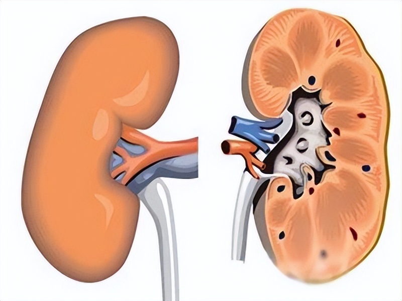 复方甘草片止咳神药,止咳药片甘草片能长期服用吗