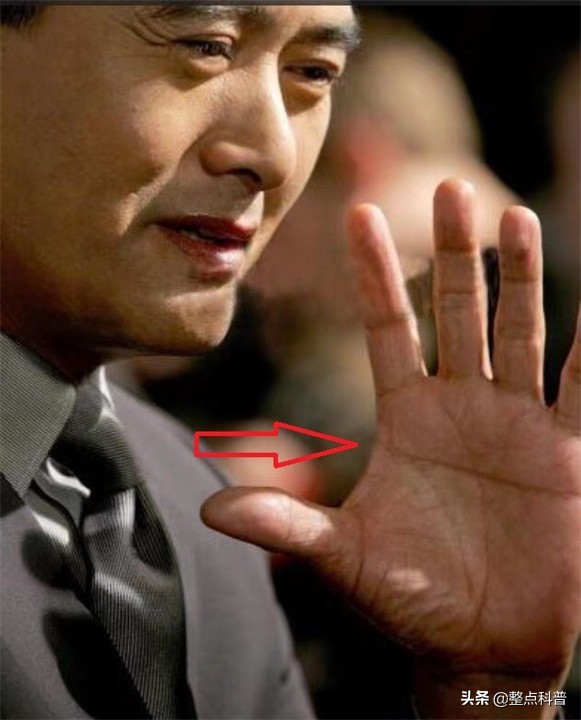 民间断掌纹说法,断掌纹与先天疾病