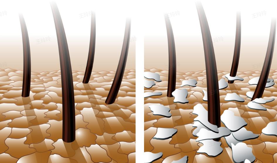 阴毛变白，就是性功能减退了？*处私**毛发的秘密，了解一下有好处