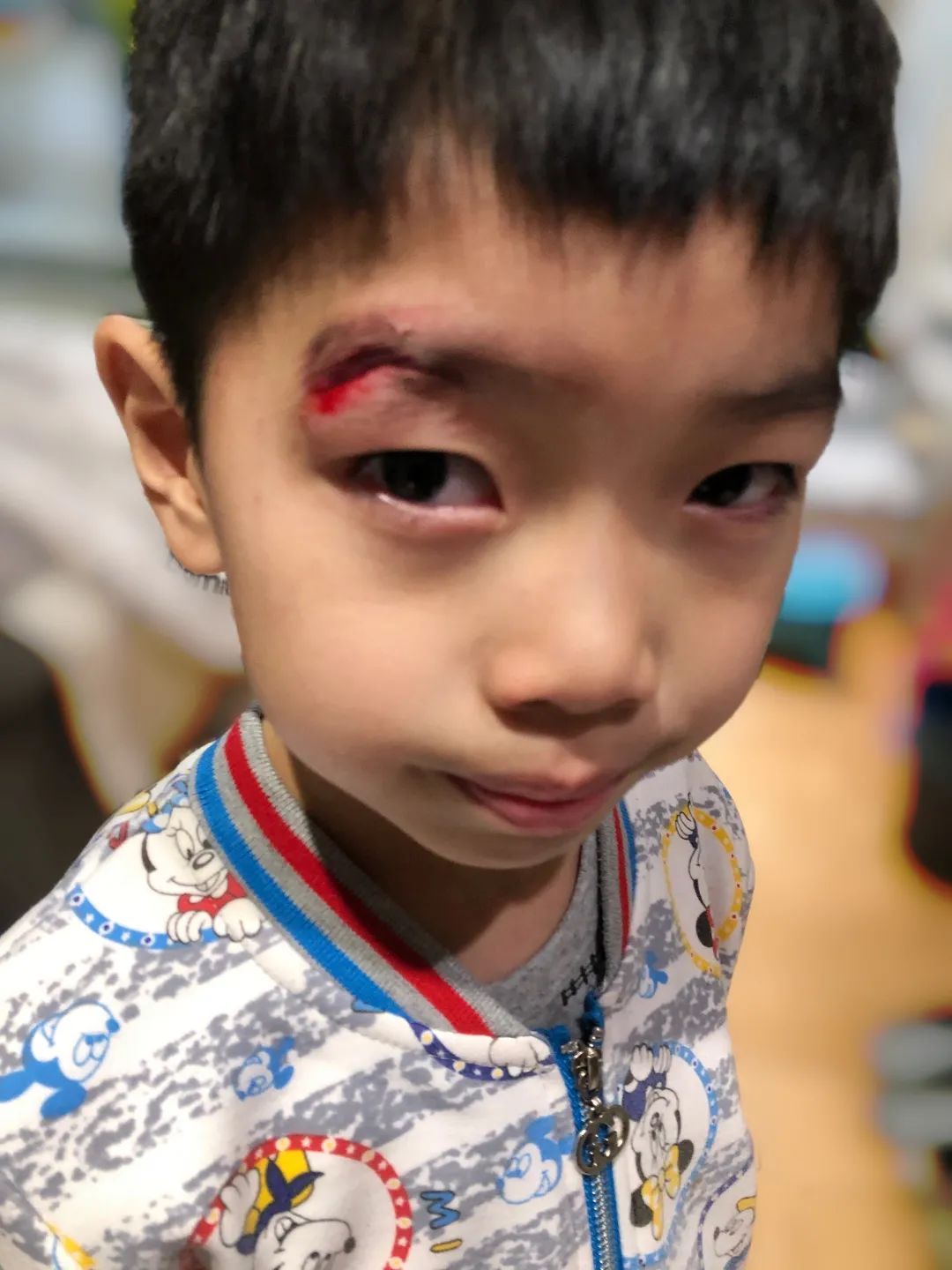 孩子磕碰怎么办,小孩子磕碰划伤擦什么药好