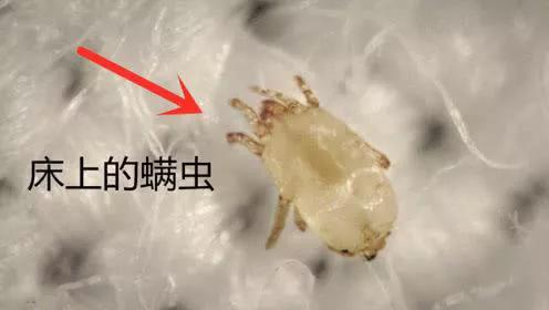 除螨你得有正确的方法,除螨小科普