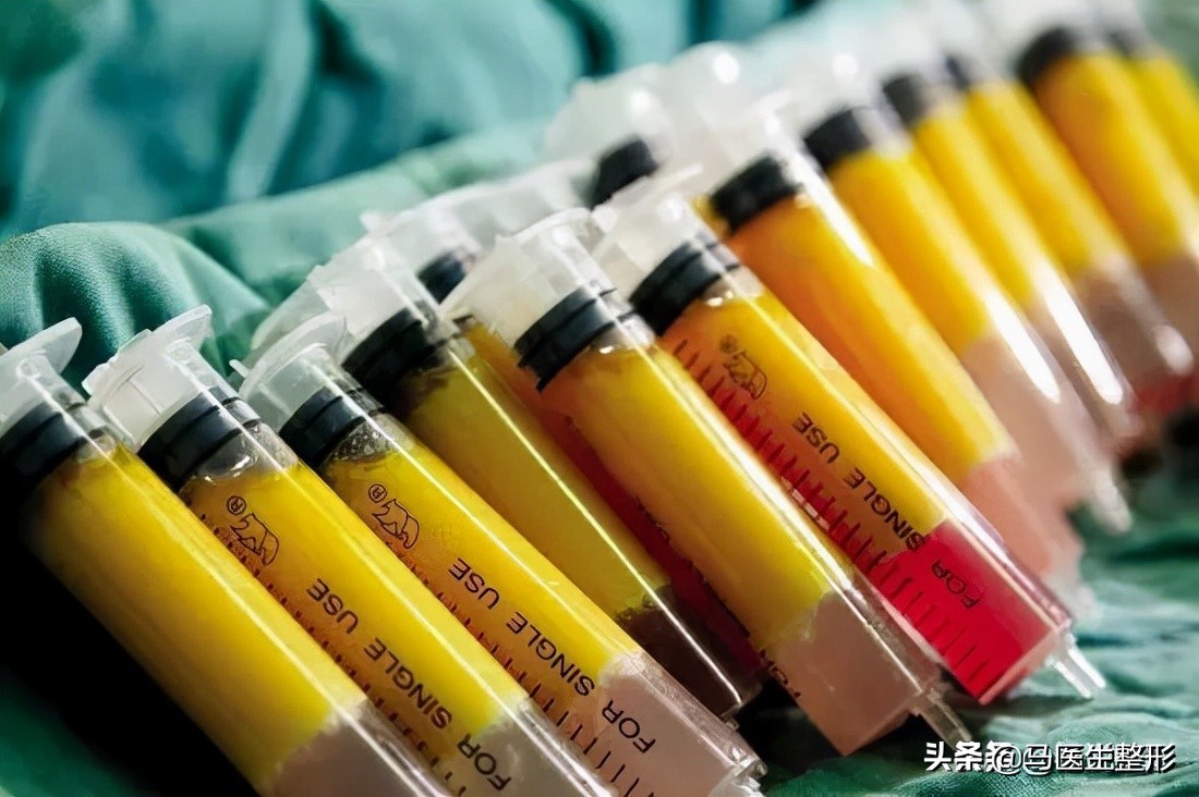 9种祛皱纹方法,除皱4招轻松应对脸部皱纹