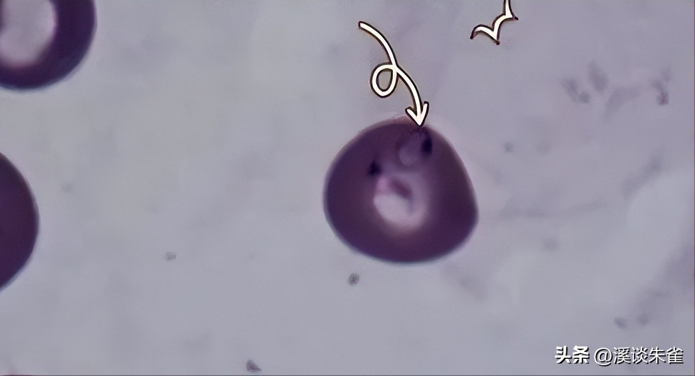 巴西布兰格斯牛和内洛尔牛中,探索双叉巴贝虫和蜱虫的季节性波动