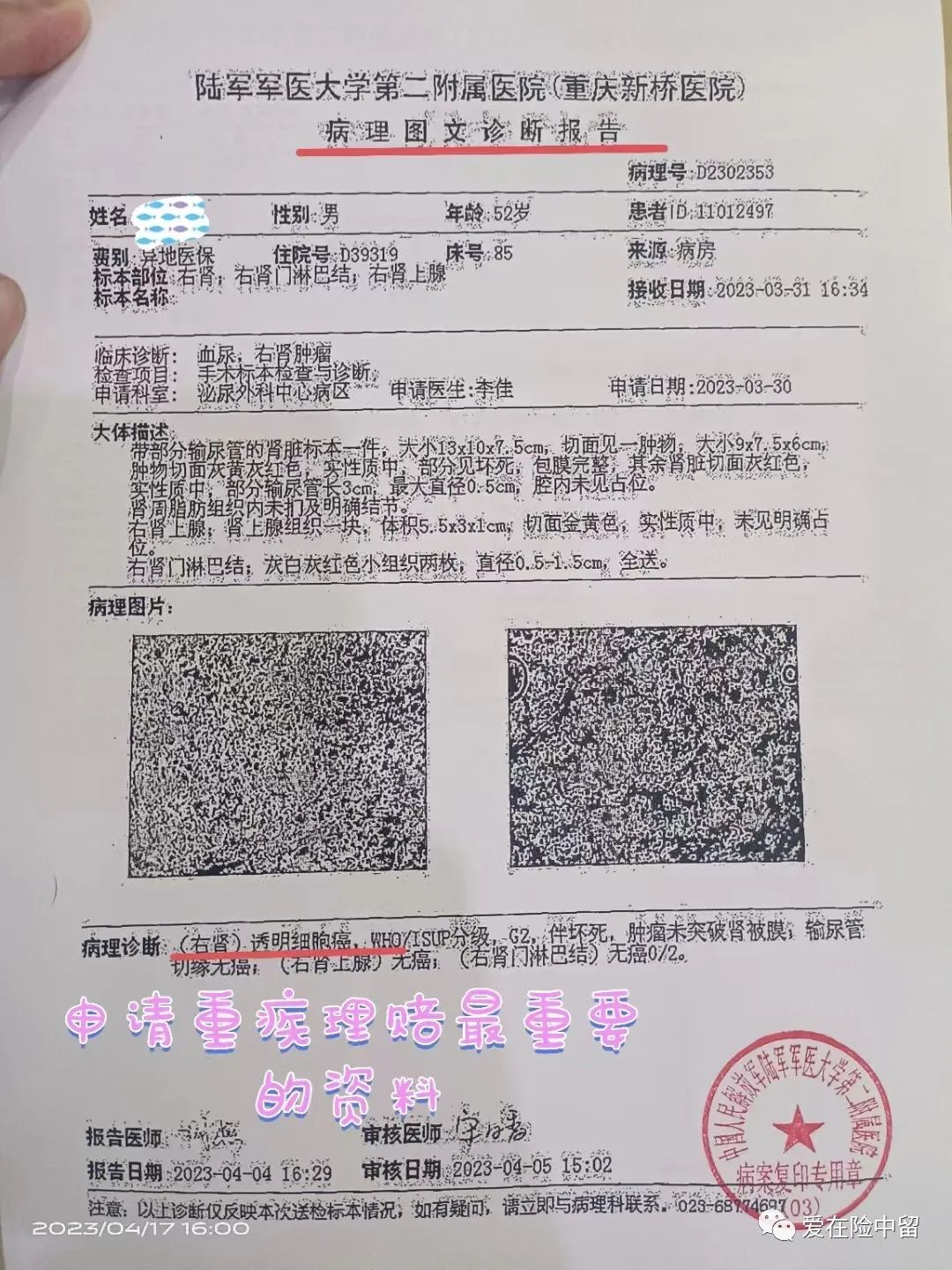 买保险和没买保险的对比,买保险和买保险产品有区别吗