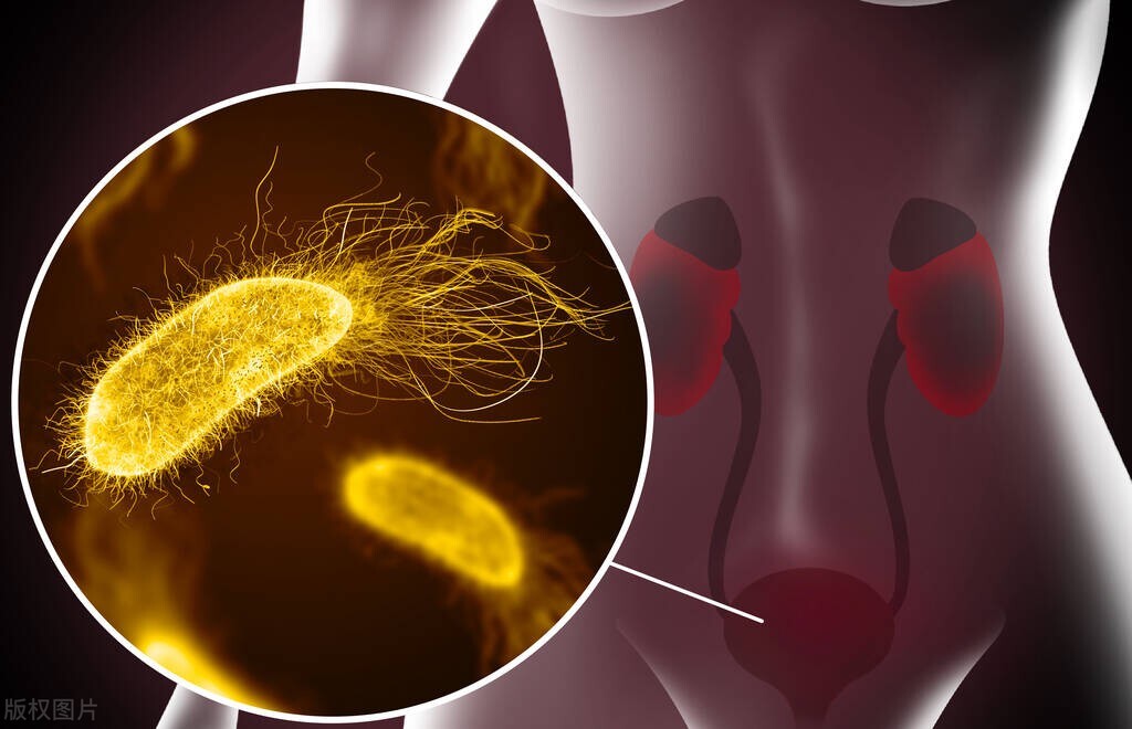 夫妻生活后,需要马上小便吗?有什么益处?别害羞,早知早受益