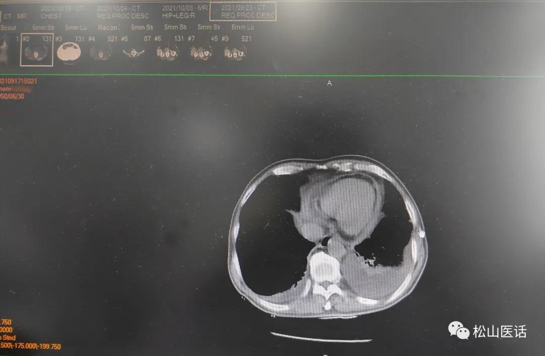 松山医话完整版,松山医话解说
