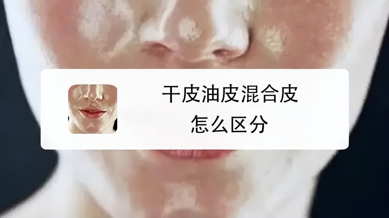 夏混油冬混干精华,夏混油冬混干冬天该用什么保湿