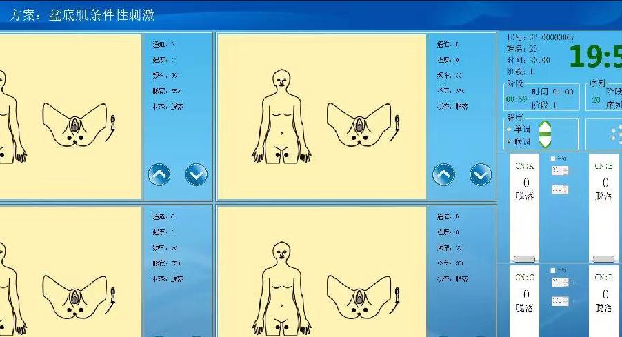 痛苦的疾病治疗,几种不需要治疗的妇科疾病