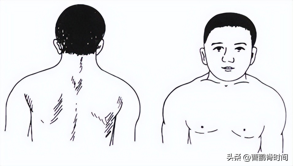 脖子两侧筋痛要警惕三种疾病,天生短脖子怎么改善