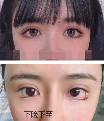 为什么医生不建议去三甲医院,三甲医院医生不建议做手术