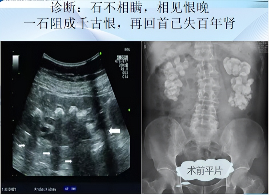 明知山有虎偏向虎山行神评论,明知山有虎偏向虎山行打一生肖