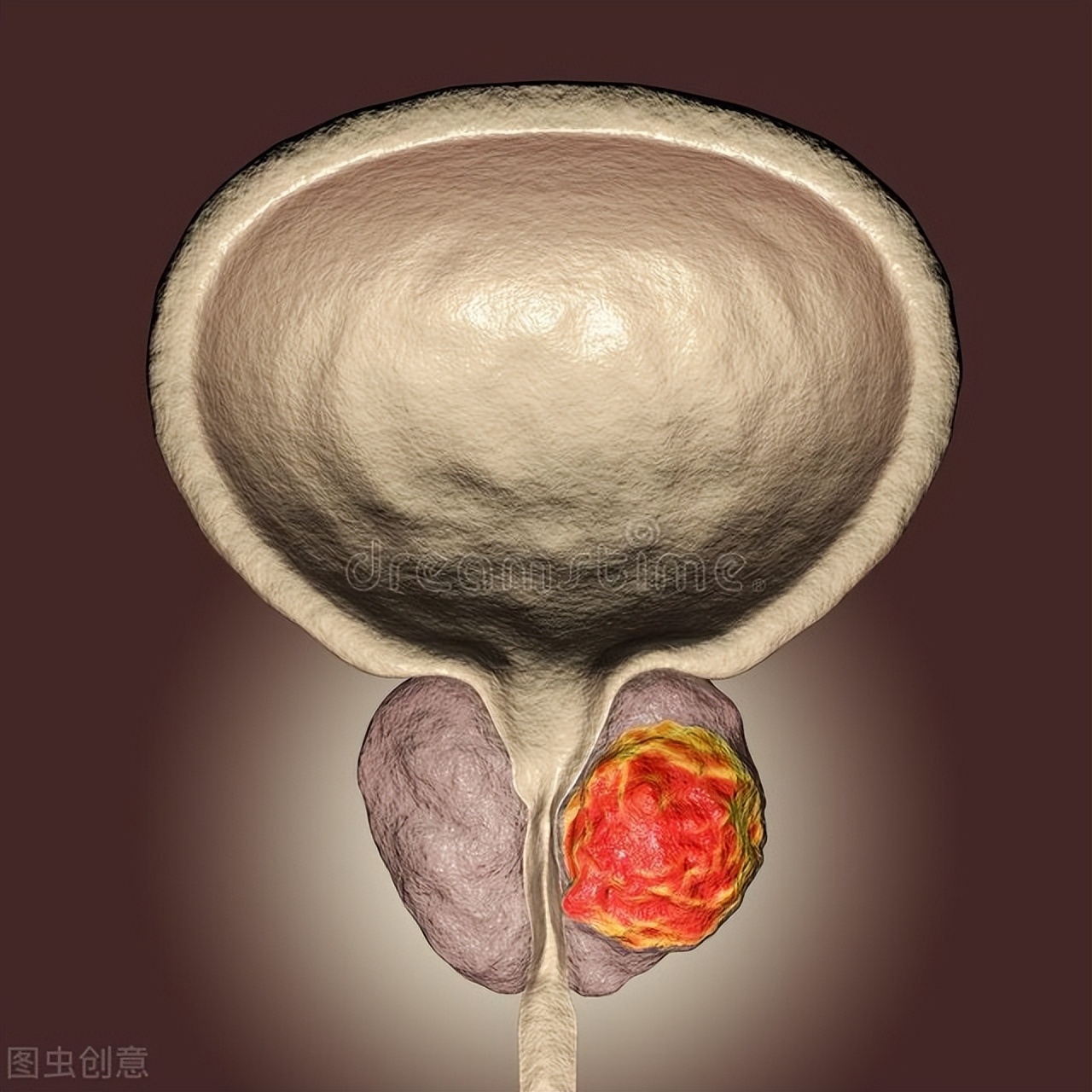 “丁丁”为什么会弯曲？