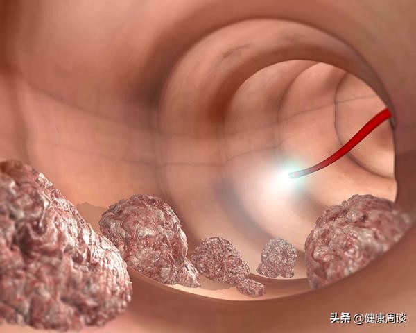 赶快来测测你的血管年龄吧,测测血管好不好