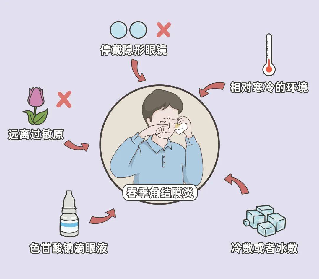 春季角结膜炎的典型体征,春季角结膜炎怎么治疗