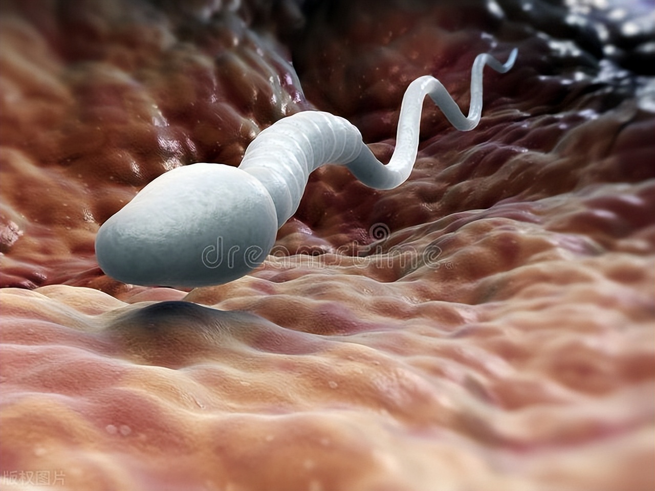 精子变黄有啥病,精子变黄是什么病