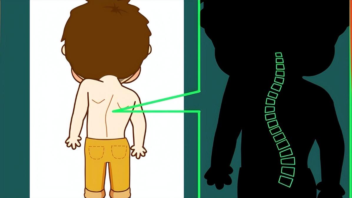 一直保持正确坐姿不得脊椎病吗,腰背挺直的正确姿势