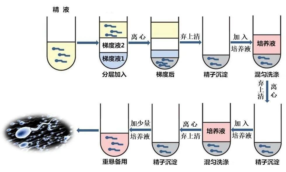 试管前怎么调理提高精子质量,做试管的精子检查需要检查哪些