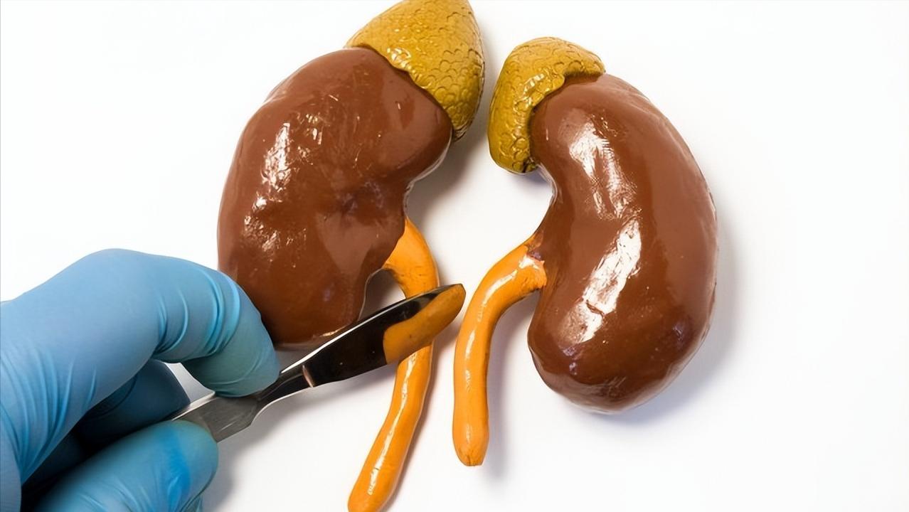 肾积水是会造成什么后果,肾积水能引起什么后果